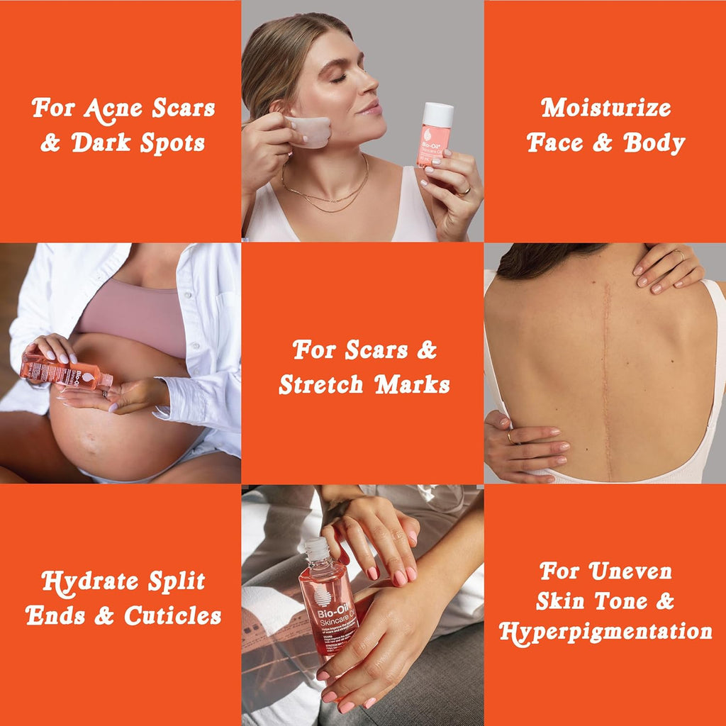 Bio-Oil Skincare Oil, 6.7 Ounce, Body Oil for Scars and Stretchmarks, Hydrates Skin, Non-Greasy